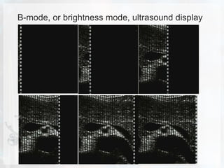 Basic physics of ultrasound.JH