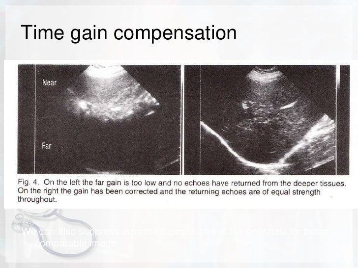 Basic physics of ultrasound.JH