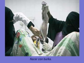 Nacer con burka. 