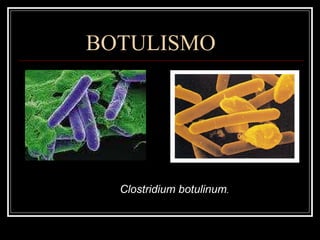 BOTULISMO Clostridium botulinum . 