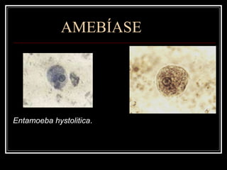 AMEBÍASE Entamoeba hystolitica . 