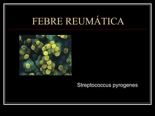 FEBRE REUMÁTICA Streptococcus pyrogenes 