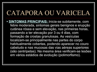 CATAPORA OU VARICELA •  SINTOMAS PRINCIPAIS:  Inicia-se subitamente, com febre moderada, sintomas gerais benignos e erupção cutânea rósea e sem elevação, nas primeiras horas, passando a ter elevação por 3 ou 4 dias, com formação de crostas granulosas. As vesículas localizam-se principalmente nas partes do corpo habitualmente cobertas, podendo aparecer no couro cabeludo e nas mucosas das vias aéreas superiores (são centrípetas). Na mesma área verificam-se lesões em vários estádios de evolução (polimorfismo).  