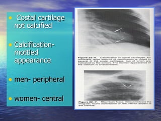 Costal cartilage not calcified Calcification- mottled appearance men- peripheral women- central 