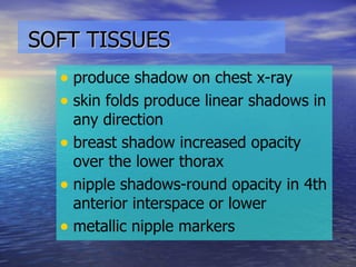 SOFT TISSUES   produce shadow on chest x-ray skin folds produce linear shadows in any direction breast shadow increased opacity over the lower thorax  nipple shadows-round opacity in 4th anterior interspace or lower metallic nipple markers 