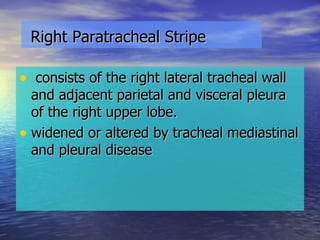 Right Paratracheal Stripe consists of the right lateral tracheal wall and adjacent parietal and visceral pleura of the right upper lobe. widened or altered by tracheal mediastinal and pleural disease 