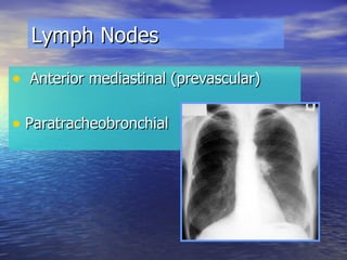 Lymph Nodes Anterior mediastinal (prevascular) Paratracheobronchial 