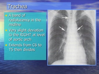 Trachea A band of radiolucency in the midline Very slight deviation to the RIGHT at level of aortic arch Extends from C6 to T5 then divides 