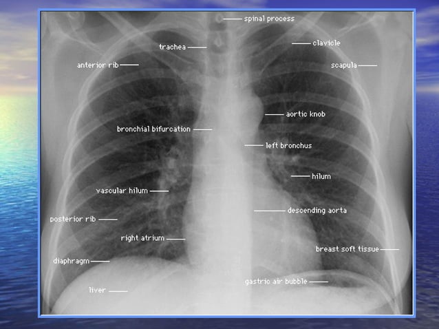 BASIC RADIOLOGY | PPT