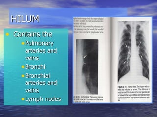 HILUM Contains the Pulmonary arteries and veins Bronchi Bronchial arteries and veins Lymph nodes 