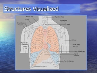 Structures Visualized 