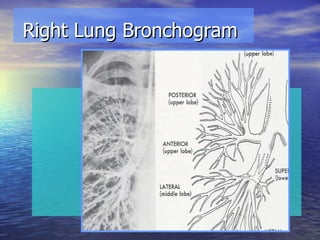 Right Lung Bronchogram 
