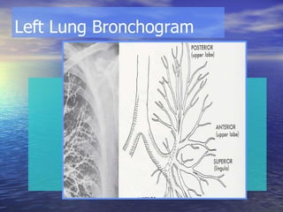 Left Lung Bronchogram 