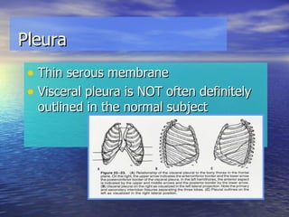 Thin serous membrane Visceral pleura is NOT often definitely outlined in the normal subject Pleura  
