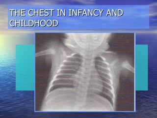 THE CHEST IN INFANCY AND CHILDHOOD 