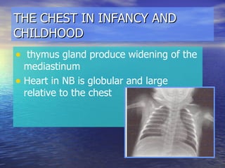 THE CHEST IN INFANCY AND CHILDHOOD thymus gland produce widening of the mediastinum Heart in NB is globular and large relative to the chest 