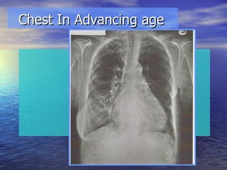 Chest In Advancing age 