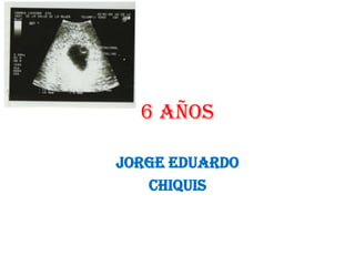 6 AÑOS  Jorge Eduardo CHIQUIS 