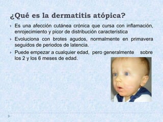 ¿Qué es la dermatitis atópica?Es una afección cutánea crónica que cursa con inflamación, enrojecimiento y picor de distribución característicaEvoluciona con brotes agudos, normalmente en primavera seguidos de periodos de latencia.Puede empezar a cualquier edad, pero generalmente	sobre los 2 y los 6 meses de edad.