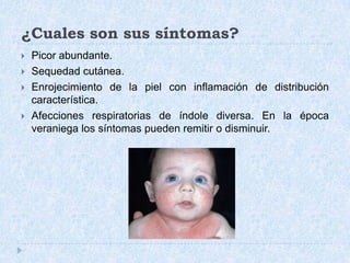 ¿Cuales son sus síntomas?Picor abundante. Sequedad cutánea.Enrojecimiento de la piel con inflamación de distribución característica.Afecciones respiratorias de índole diversa. En la época veraniega los síntomas pueden remitir o disminuir. 