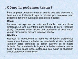 ¿Cómo la podemos tratar?Para empezar debemos tener en cuenta que esta afección no tiene cura ni tratamiento que la elimine por completo, pero podemos  tener en cuenta las siguientes medidas:Ropa:  	La ropa de algodón es más confortable que las fibras sintéticas. La lana es irritante para el bebé de por sí (produce picor). Debemos evitar tejidos que produzcan al bebé sudar ya que dicho sudor provoca irritación al niño.Dietética:  	Retrasar la introducción al bebé de alimentos alergénicos como son el huevo y la leche de vaca hasta el año de edad. También estos alimentos se deben suprimir de la madre lactante. Se recomienda la ingesta de leche materna para el bebé ya que posee unas sustancias que evitan la absorción de los alérgenos alimenticios.