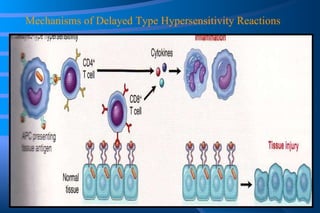 Mechanisms of Delayed Type Hypersensitivity Reactions 