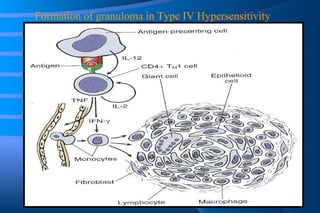 Formation of granuloma in Type IV Hypersensitivity 
