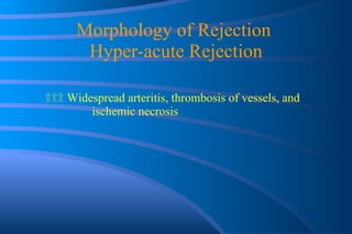 Morphology of Rejection  Hyper-acute Rejection ۩۩۩   Widespread arteritis, thrombosis of vessels, and  ischemic necrosis 