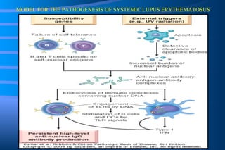 MODEL FOR THE PATHOGENESIS OF SYSTEMIC LUPUS ERYTHEMATOSUS 