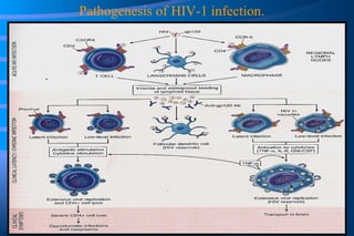 Pathogenesis of HIV-1 infection. 
