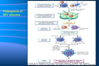 Pathogenesis of HIV infection 