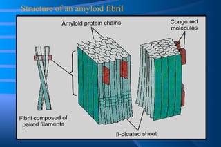 Structure of an amyloid fibril 