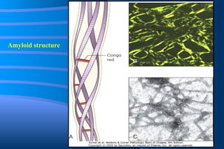 Amyloid structure 