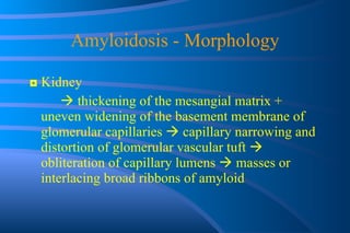 Amyloidosis - Morphology ◘  Kidney    thickening of the mesangial matrix + uneven widening of the basement membrane of glomerular capillaries    capillary narrowing and distortion of glomerular vascular tuft    obliteration of capillary lumens    masses or interlacing broad ribbons of amyloid 