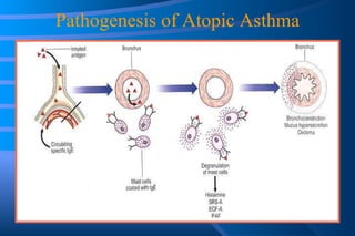Pathogenesis of Atopic Asthma 