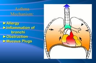 Asthma Mechanism: ► Allergy ► Inflammation of  bronchi ► Obstruction ► Mucous Plugs 