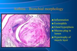 Asthma - Bronchial morphology ◘  Inflammation  ◘  Eosinophils ◘  Gland hyperplasia ◘  Mucous plug in lumen ◘  Hypertrophy of muscle layer 