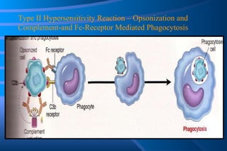 Type II Hypersensitivity Reaction – Opsonization and Complement-and Fc-Receptor Mediated Phagocytosis 