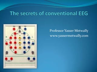 The secrets of conventional EEG Professor Yasser Metwally www.yassermetwally.com 