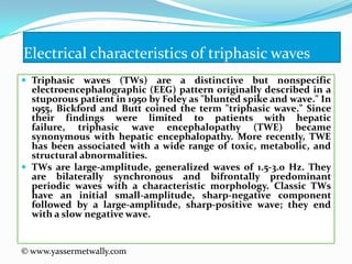 Issues in brainmapping...The secrets of conventional EEG | PPTX