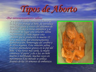 Tipos de Aborto -Por envenenamiento salino Se extrae el líquido amniótico dentro de la bolsa que protege al bebé. Se introduce una larga aguja a través del abdomen de la madre, hasta la bolsa amniótica y se inyecta en su lugar una solución salina concentrada. El bebé ingiere esta solución que le producirá la muerte 12 horas más tarde por envenenamiento, deshidratación, hemorragia del cerebro y de otros órganos. Esta solución salina produce quemaduras graves en la piel del bebé. Unas horas más tarde, la madre comienza "el parto" y da a luz un bebé muerto o moribundo, muchas veces en movimiento.Este método se utiliza después de las 16 semanas de embarazo. 