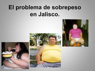 El problema de sobrepeso en Jalisco. 