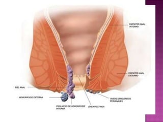 ESTÁN LOCALIZADAS EN LOS ÚLTIMOS CENTÍMETROS DEL RECTO.