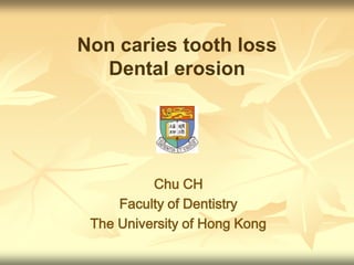 Non caries tooth loss Dental erosion Chu CH Faculty of Dentistry The University of Hong Kong 