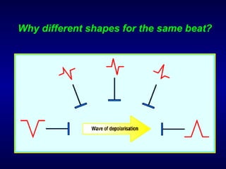 Why different shapes for the same beat? 