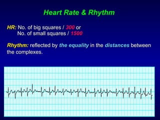 Heart Rate & Rhythm HR:   No. of big squares /  300   or    No. of small squares /  1500 Rhythm:   reflected by  the equality  in the  distances  between the complexes .   