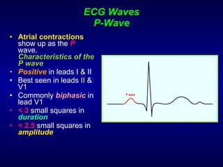 ECG Waves P-Wave Atrial contractions  show up as the  P   wave.  Characteristics of the P wave Positive  in leads I & II Best seen in leads II &  V1 Commonly  biphasic  in lead V1 < 3  small squares in  duration < 2.5  small squares in  amplitude 