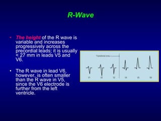 R-Wave The height  of the R wave is variable and increases progressively across the precordial leads; it is usually < 27 mm in leads V5 and V6.  The R wave in lead V6, however, is often smaller than the R wave in V5, since the V6 electrode is further from the left ventricle. 