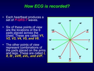 How ECG is recorded? Each heartbeat produces a set of  P-QRS-T  waves. Six of these points of view are the locations of the 6 pads placed across the chest. These are called  V1, V2, V3, V4, V5, and V6 .  The other points of view represent combinations of the pads placed on the arms and legs. These are called  I, II, III , aVR, aVL, and aVF.    