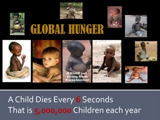 GLOBAL HUNGER A Child Dies Every 6Seconds That is 5,000,000 Children each year 